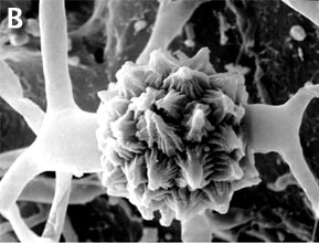 Zygospore of Mycotypha africana